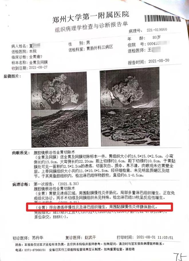 老汉患慢性胃炎医生竟按胃癌晚期切除全胃事发郑州详情曝出(图7)